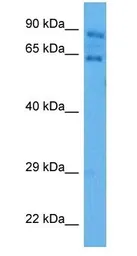 Anti-AIRE antibody used in Western Blot (WB). GTX04257