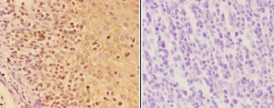 Anti-AIRE antibody used in IHC (Paraffin sections) (IHC-P). GTX04258