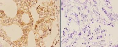 Anti-AIRE antibody used in IHC (Paraffin sections) (IHC-P). GTX04258