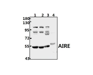 Anti-AIRE antibody used in Western Blot (WB). GTX04258