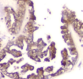 Anti-Cyclophilin B antibody [11C11] used in IHC (Paraffin sections) (IHC-P). GTX04262