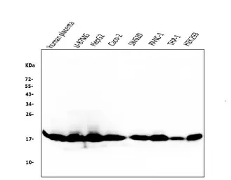 Anti-Cyclophilin B antibody [11C11] used in Western Blot (WB). GTX04262