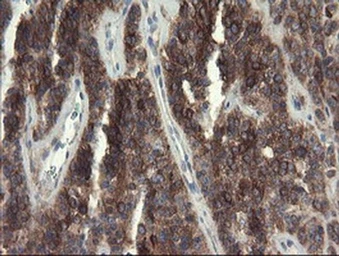 Anti-EIF5A2 antibody [OTI6G7] used in IHC (Paraffin sections) (IHC-P). GTX04263