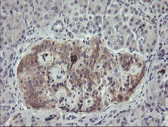 Anti-EIF5A2 antibody [OTI6G7] used in IHC (Paraffin sections) (IHC-P). GTX04263
