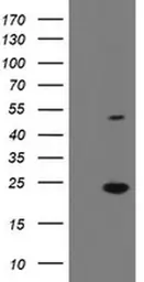 Anti-EIF5A2 antibody [OTI6G7] used in Western Blot (WB). GTX04263