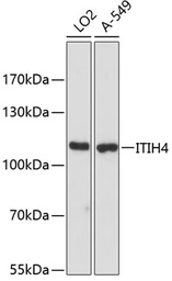 Anti-ITIH4 antibody used in Western Blot (WB). GTX04264