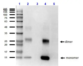 Anti-Hemoglobin beta antibody [14G2.G11.F11] used in Western Blot (WB). GTX04267