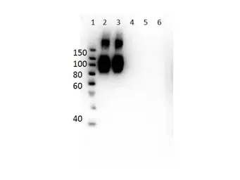 Anti-Hemoglobin beta antibody [14G2.G11.F11] used in Western Blot (WB). GTX04267