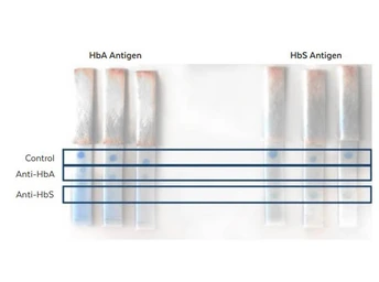 Anti-Hemoglobin beta S antibody [23E5.H6.G6.C1.H7.F7.G9.F6] used in Lateral Flow (Lateral Flow). GTX04268