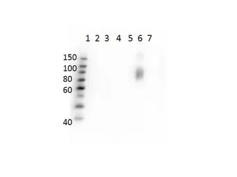 Anti-Hemoglobin beta S antibody [23E5.H6.G6.C1.H7.F7.G9.F6] used in Western Blot (WB). GTX04268