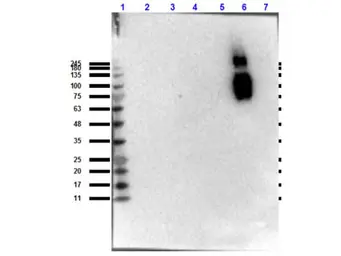 Anti-Hemoglobin beta S antibody [23E5.H6.G6.C1.H7.F7.G9.F6] used in Western Blot (WB). GTX04268