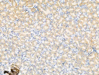 Anti-Glycine Receptor alpha 2 antibody used in IHC (Paraffin sections) (IHC-P). GTX04297