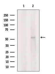 Anti-Glycine Receptor alpha 2 antibody used in Western Blot (WB). GTX04297