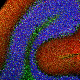 Anti-alpha Synuclein antibody [2A7] used in IHC (Free Floating) (IHC (Free Floating)). GTX04298
