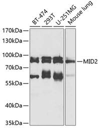 Anti-MID2 antibody used in Western Blot (WB). GTX04305
