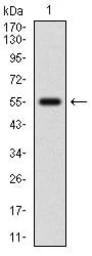 Anti-NRF2 antibody [1A6G6] used in Western Blot (WB). GTX04306