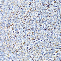 Anti-TP53I11 antibody used in IHC (Paraffin sections) (IHC-P). GTX04308