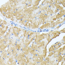 Anti-TP53I11 antibody used in IHC (Paraffin sections) (IHC-P). GTX04308