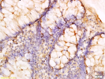 Anti-Adiponectin Receptor 2 antibody used in IHC (Paraffin sections) (IHC-P). GTX04314