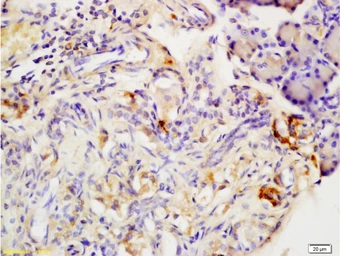 Anti-Adiponectin Receptor 2 antibody used in IHC (Paraffin sections) (IHC-P). GTX04314