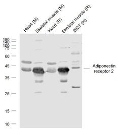 Anti-Adiponectin Receptor 2 antibody used in Western Blot (WB). GTX04314