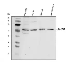 Anti-AMFR antibody used in Western Blot (WB). GTX04315