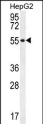 Anti-UXS1 antibody used in Western Blot (WB). GTX04317