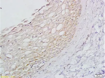 Anti-beta 1 Adrenergic Receptor antibody used in IHC (Paraffin sections) (IHC-P). GTX04321