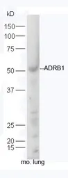Anti-beta 1 Adrenergic Receptor antibody used in Western Blot (WB). GTX04321