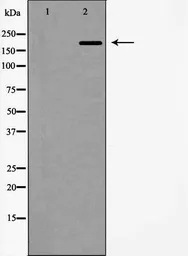 Anti-WNK3 antibody used in Immunocytochemistry/ Immunofluorescence (ICC/IF). GTX04322