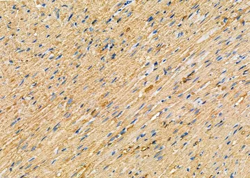 Anti-WNK3 antibody used in IHC (Paraffin sections) (IHC-P). GTX04322