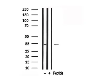 Anti-Coagulation factor III/Tissue Factor antibody used in Western Blot (WB). GTX04323