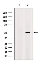 Anti-Coagulation factor III/Tissue Factor antibody used in Western Blot (WB). GTX04323