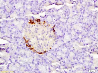 Anti-Coagulation factor III/Tissue Factor antibody used in IHC (Paraffin sections) (IHC-P). GTX04324