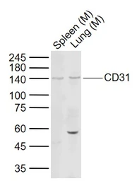 Anti-CD31 antibody used in Western Blot (WB). GTX04325