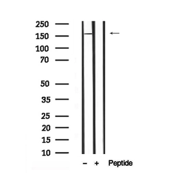 Anti-DEPDC5 (phospho Ser1530) antibody used in Western Blot (WB). GTX04328