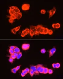 Anti-USP18 antibody used in Immunocytochemistry/ Immunofluorescence (ICC/IF). GTX04331