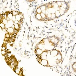 Anti-USP18 antibody used in IHC (Paraffin sections) (IHC-P). GTX04331