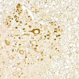 Anti-USP18 antibody used in IHC (Paraffin sections) (IHC-P). GTX04331