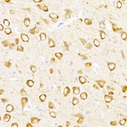 Anti-USP18 antibody used in IHC (Paraffin sections) (IHC-P). GTX04331