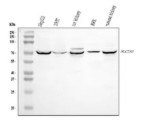 Anti-SGLT1 antibody used in Western Blot (WB). GTX04333