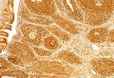 Anti-mTOR antibody used in IHC (Paraffin sections) (IHC-P). GTX04334
