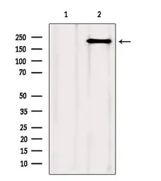 Anti-mTOR antibody used in Western Blot (WB). GTX04334