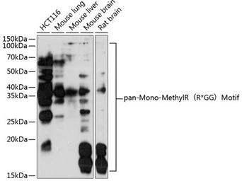 Anti-pan-Mono-MethylR (R*GG) Motif antibody used in Western Blot (WB). GTX04340