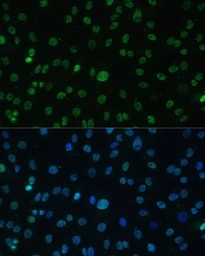 Anti-HSF1 antibody used in Immunocytochemistry/ Immunofluorescence (ICC/IF). GTX04342