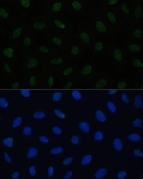Anti-HSF1 antibody used in Immunocytochemistry/ Immunofluorescence (ICC/IF). GTX04342