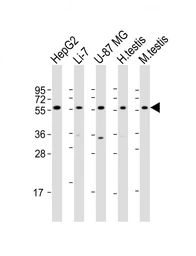 Anti-DHCR7 antibody used in Western Blot (WB). GTX04343
