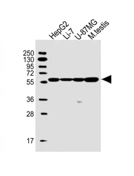 Anti-DHCR7 antibody used in Western Blot (WB). GTX04343