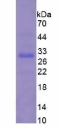Mouse Cardiac Troponin I protein, His tag. GTX04344-pro