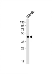 Anti-SHARP1 antibody used in Western Blot (WB). GTX04346